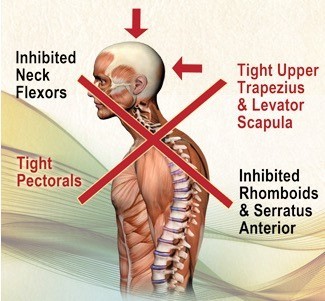Althos FITNESS neck posture