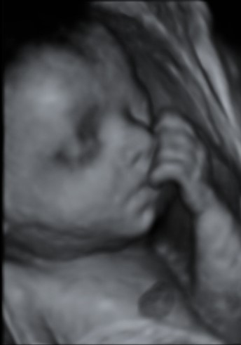 Baby Scan black and white