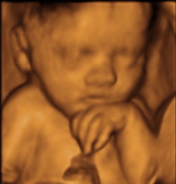 Baby Scan gold