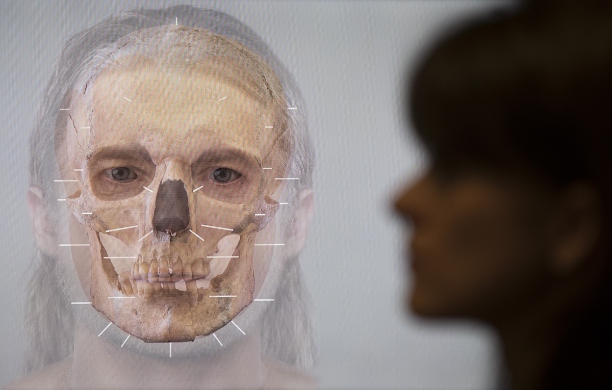 Facial reconstruction