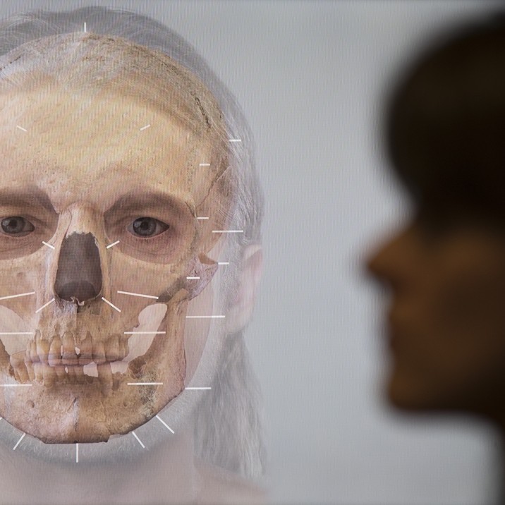 Facial reconstruction