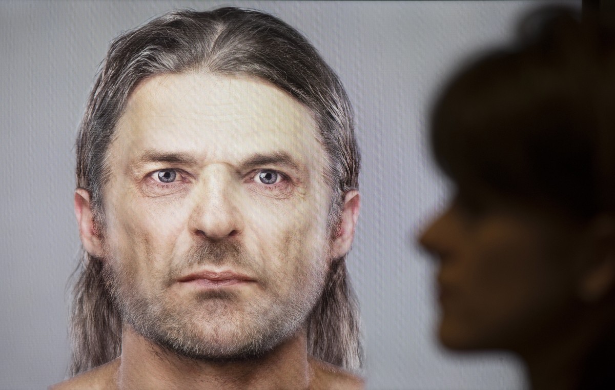 Completed facial reconstruction