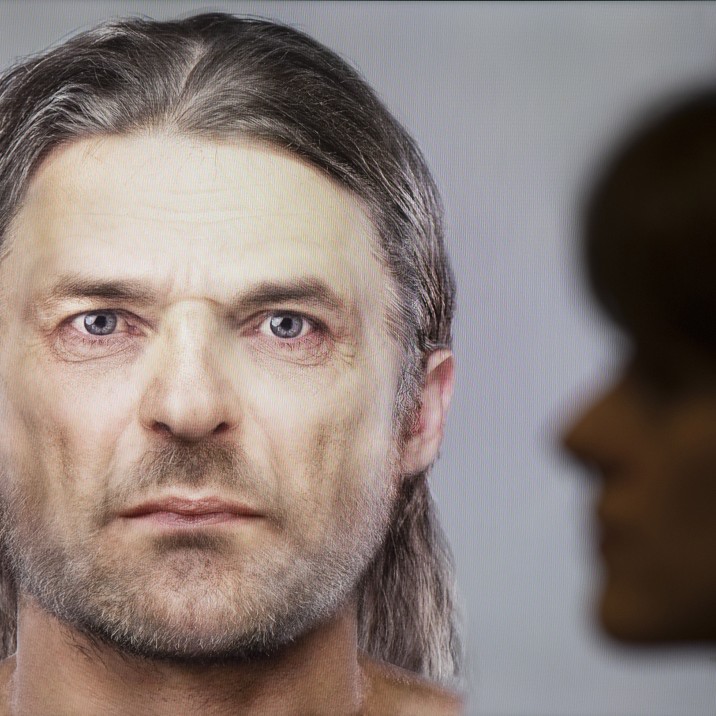 Completed facial reconstruction